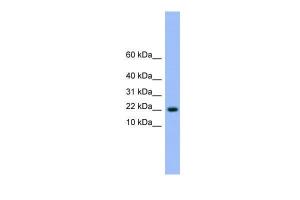 Anti-NXT1 Rabbit Polyclonal Antibody