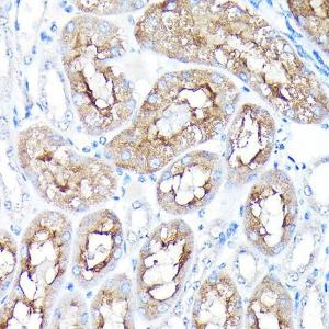 Immunohistochemistry analysis of paraffin-embedded mouse kidney using Anti-PEG10 / EDR Antibody (A9086) at a dilution of 1:100 (40x lens). Perform high pressure antigen retrieval with 10 mM citrate buffer pH 6.0 before commencing with IHC staining protocol.