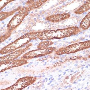 Immunohistochemistry analysis of paraffin-embedded rat kidney using Anti-Gemin 5 Antibody (A93227) at a dilution of 1:100 (40X lens)