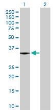 Anti-MGLL Rabbit Polyclonal Antibody