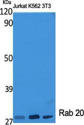 Western blot analysis of various cells using Anti-RAB20 Antibody