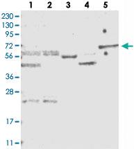 Anti-AIM1L Rabbit Polyclonal Antibody