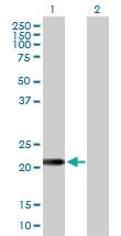 Anti-EFCAB2 Mouse Polyclonal Antibody