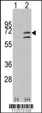 Anti-MAP Kinase 15 Rabbit Polyclonal Antibody (APC (Allophycocyanin))