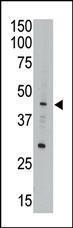 Anti-APOBEC3G Rabbit Polyclonal Antibody (Biotin)