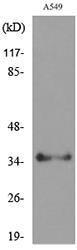 Western blot analysis of lysate from A549 cells using Anti-APE1 (acetyl Lys6) Antibody