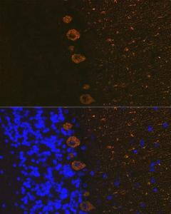 Immunofluorescence analysis of rat brain using Anti-IP3 receptor Antibody [ARC1007] (A306244) at a dilution of 1:100 (40X lens). DAPI was used to stain the cell nuclei (blue)