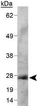 Anti-NKX3-1 Mouse Monoclonal Antibody