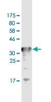 Anti-TFRC Mouse Monoclonal Antibody [clone: 1H5]