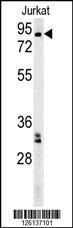 Anti-GGNBP2 Rabbit Polyclonal Antibody (HRP (Horseradish Peroxidase))