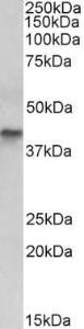 E12359 (0.03 µg/ml) staining of Human Colon cancer lysate (35 µg protein in RIPA buffer). Primary incubation was 1 hour. Detected by chemilu minescence