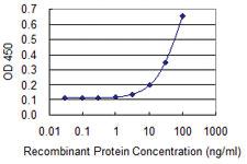 Anti-MRE11A Mouse Monoclonal Antibody [clone: 3H4-F4]