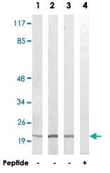 Anti-MRPS17 Rabbit Polyclonal Antibody