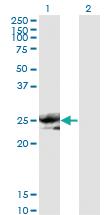 Anti-NOG Mouse Monoclonal Antibody [clone: 2C10]