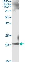 Anti-ANK1 Antibody Pair