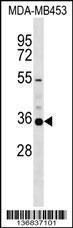 Anti-KCNA5 Rabbit Polyclonal Antibody (AP (Alkaline Phosphatase))