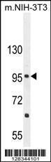 Anti-CCDC39 Rabbit Polyclonal Antibody (Biotin)