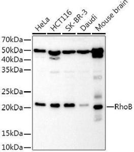 Antibody anti-RHOB 100 µl