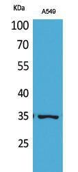 Western blot analysis of A549 cells using Anti-APE1 (acetyl Lys6) Antibody