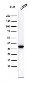 Anti-Prohibitin antibody