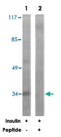 Anti-CEBPE Rabbit Polyclonal Antibody