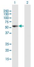 Anti-VIM Mouse Polyclonal Antibody