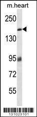 Anti-MYBPC3 Rabbit Polyclonal Antibody