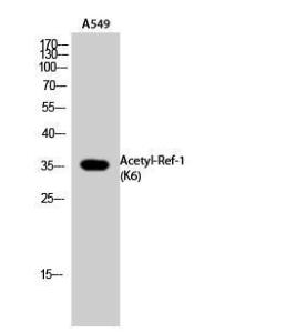 Western blot analysis of A549 cells using Anti-APE1 (acetyl Lys6) Antibody