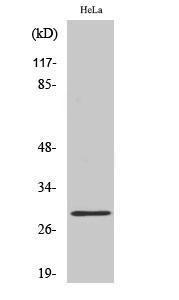 Western blot analysis of A549 cells using Anti-RAB20 Antibody