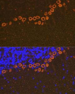 Immunofluorescence analysis of mouse brain using Anti-IP3 receptor Antibody [ARC1007] (A306244) at a dilution of 1:100 (40X lens). DAPI was used to stain the cell nuclei (blue)