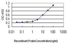 Anti-ALDOB Mouse Monoclonal Antibody [clone: 3B3]