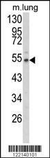 Anti-EFEMP1 Rabbit Polyclonal Antibody (AP (Alkaline Phosphatase))