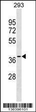 Anti-GGPS1 Rabbit Polyclonal Antibody (AP (Alkaline Phosphatase))