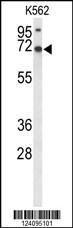 Anti-LRRC4 Rabbit Polyclonal Antibody