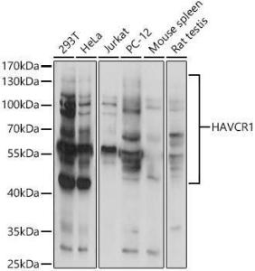 Western blot analysis of extracts of various cell lines, using Anti-TIM 1 Antibody (A9092) at 1:1,000 dilution