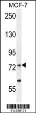 Anti-RARS Rabbit Polyclonal Antibody