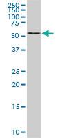 Anti-B4GALNT1 Mouse Monoclonal Antibody [clone: 5F9]