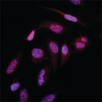 Anti-SUMO2 Mouse Monoclonal Antibody