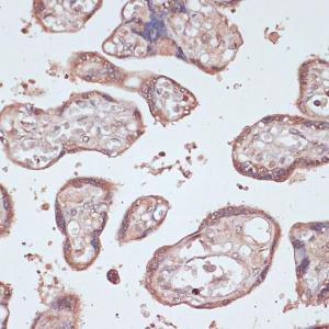 Immunohistochemistry analysis of paraffin-embedded human placenta using Anti-Gemin 5 Antibody (A93227) at a dilution of 1:100 (40X lens)