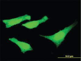 Anti-SYNE2 Mouse Monoclonal Antibody [clone: 5E5]