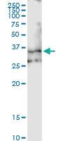 Anti-EMILIN1 Polyclonal Antibody Pair