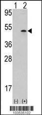 Anti-AURKB Rabbit Polyclonal Antibody (FITC (Fluorescein Isothiocyanate))