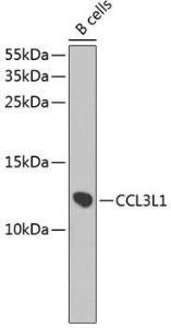 Western blot analysis of extracts of B-cell cells, using Anti-LD78 beta Antibody (A9096) at 1:1,000 dilution