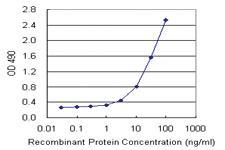 Anti-MGRN1 Polyclonal Antibody Pair