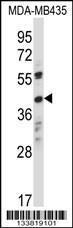 Anti-OR8K1 Rabbit Polyclonal Antibody (APC (Allophycocyanin))