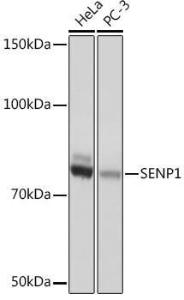 Western blot analysis of extracts of various cell lines, using Anti-SENP1 Antibody [ARC1016] (A309142) at 1:1,000 dilution The secondary antibody was Goat Anti-Rabbit IgG H&L Antibody (HRP) at 1:10,000 dilution Lysates/proteins were present at 25 µg per lane