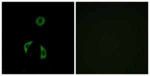 Immunofluorescence analysis of A549 cells using Anti-FZD3 Antibody. The right hand panel represents a negative control, where the antibody was pre-incubated with the immunising peptide.