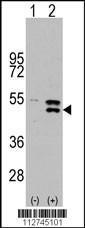 Anti-MAP Kinase Kinase 5 Rabbit Polyclonal Antibody (APC (Allophycocyanin))