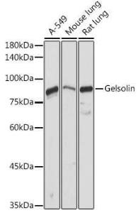 Anti-Gelsolin Rabbit Polyclonal Antibody