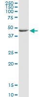 Anti-GALK2 Rabbit Polyclonal Antibody